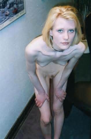 Anorexic Porn Thread NWS Page 18 Yellow Bullet Forums