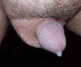 my small penis prostate milking - 100_1323Milking.jpg